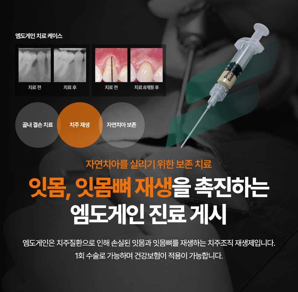 엠도게인 진료개시