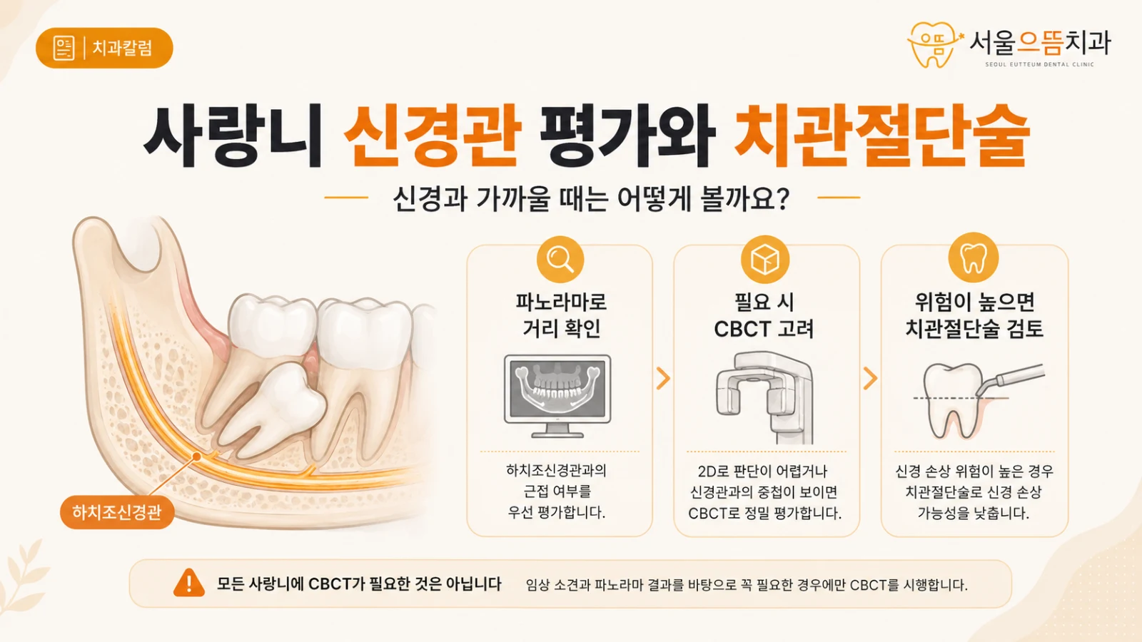 사랑니 신경관 평가와 치관절단술 하악 사랑니와 하치조신경관의 관계, 발치 위험과 치관절단술 선택을 설명한 도해