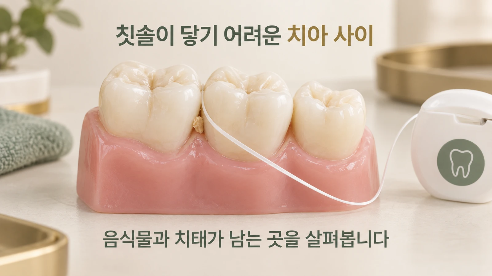 치실 냄새와 치아 사이에 남은 음식물 치아 사이에 치실과 작은 음식물 조각이 보이는 어금니 설명용 모형
