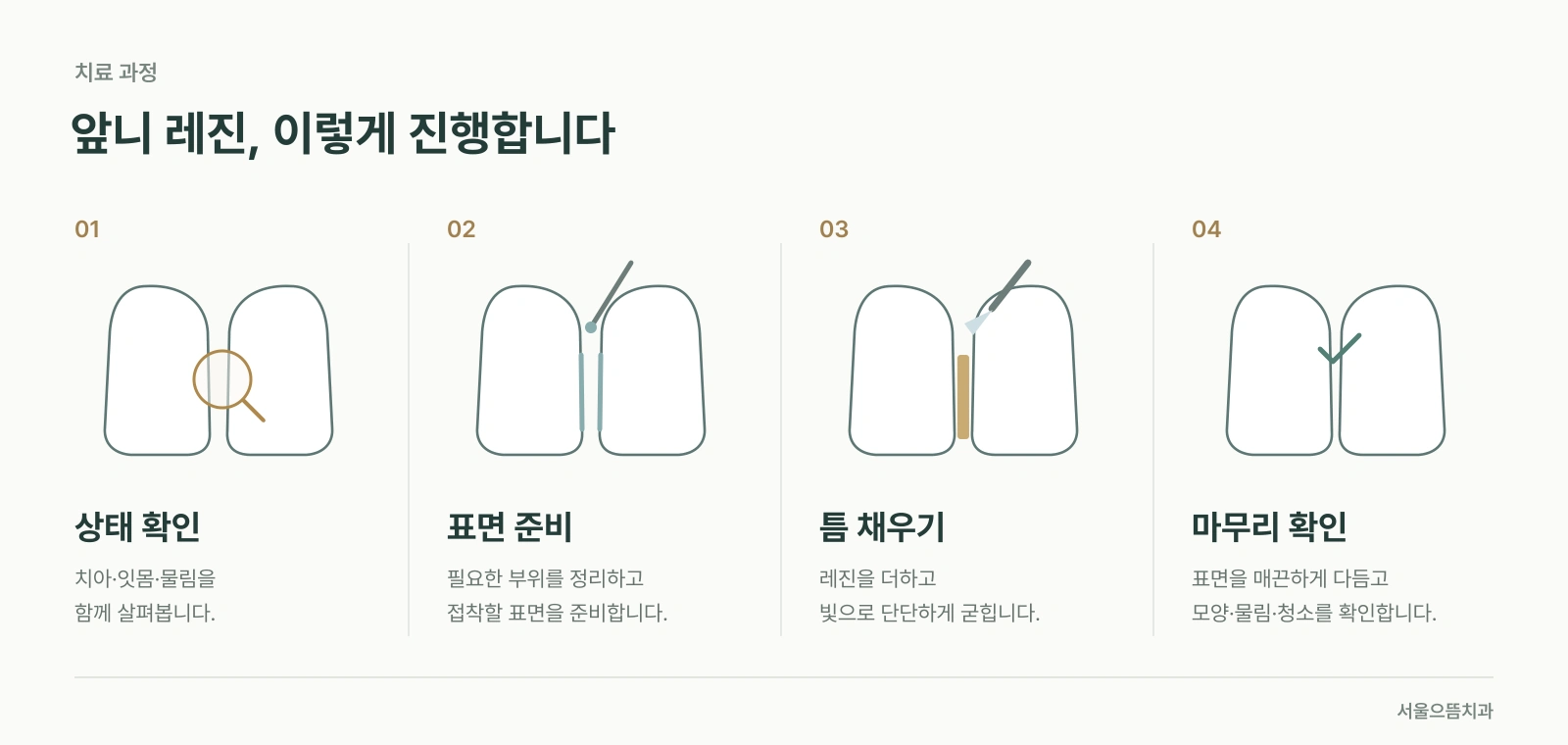 상태 확인, 표면 준비, 레진으로 틈 채우기, 마무리 확인을 순서대로 정리한 앞니 레진 치료 도식