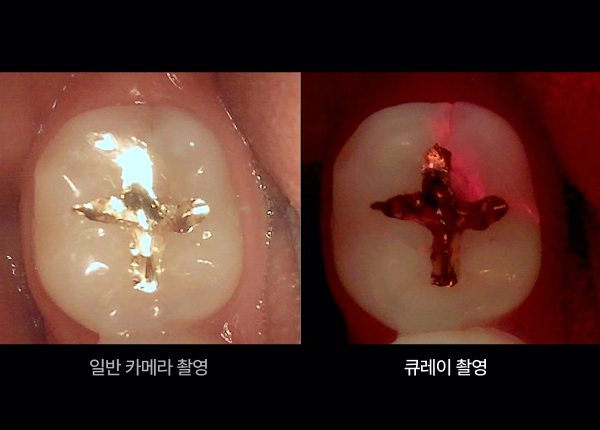일반촬영 큐레이촬영 비교 사진
