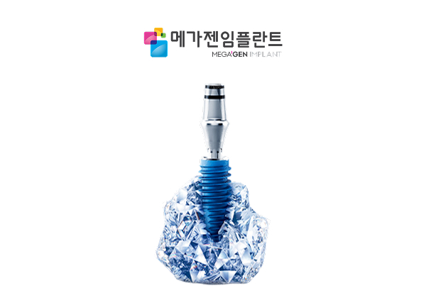 서울으뜸치과에서 안내하는 메가젠 블루다이아몬드 임플란트 제품