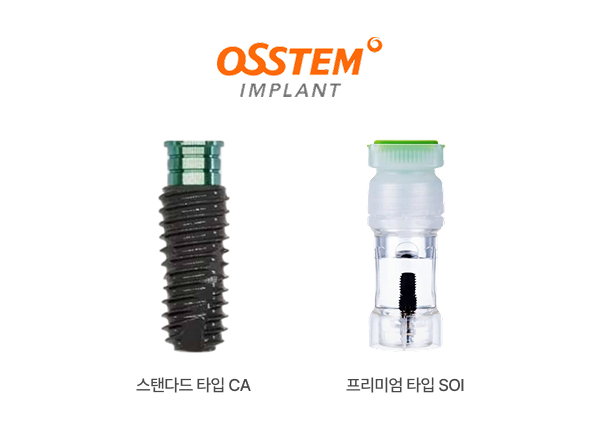 서울으뜸치과에서 안내하는 오스템 CA와 SOI 임플란트 제품