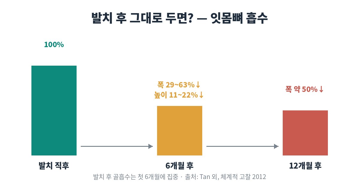 치아 상실 후 선택지 5가지 비교표 - 임플란트·브릿지·부분틀니·완전틀니·방치