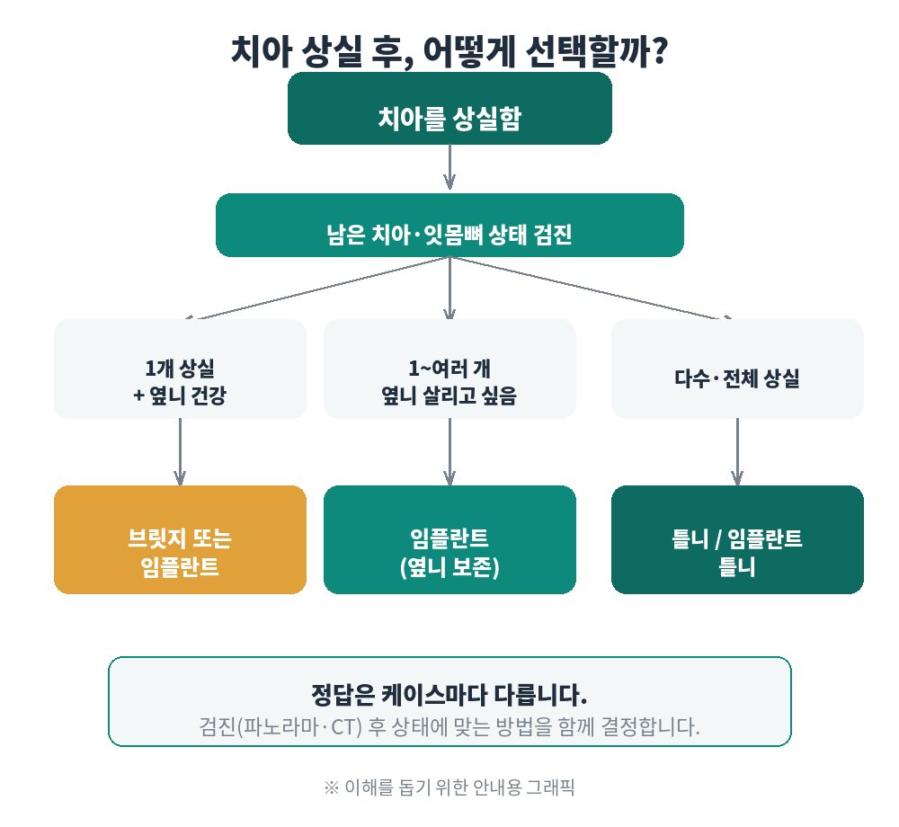 치아 상실 후 임플란트·브릿지·틀니 선택 기준 흐름도