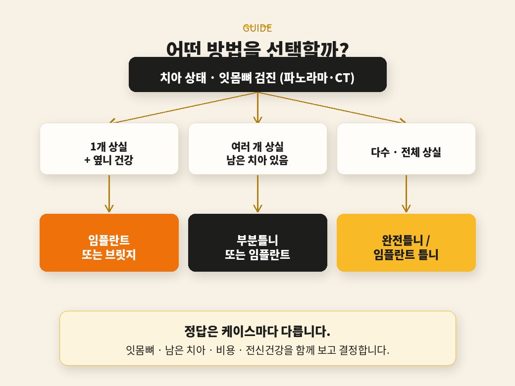 치아 상실 후 임플란트 브릿지 틀니 선택 가이드 흐름도