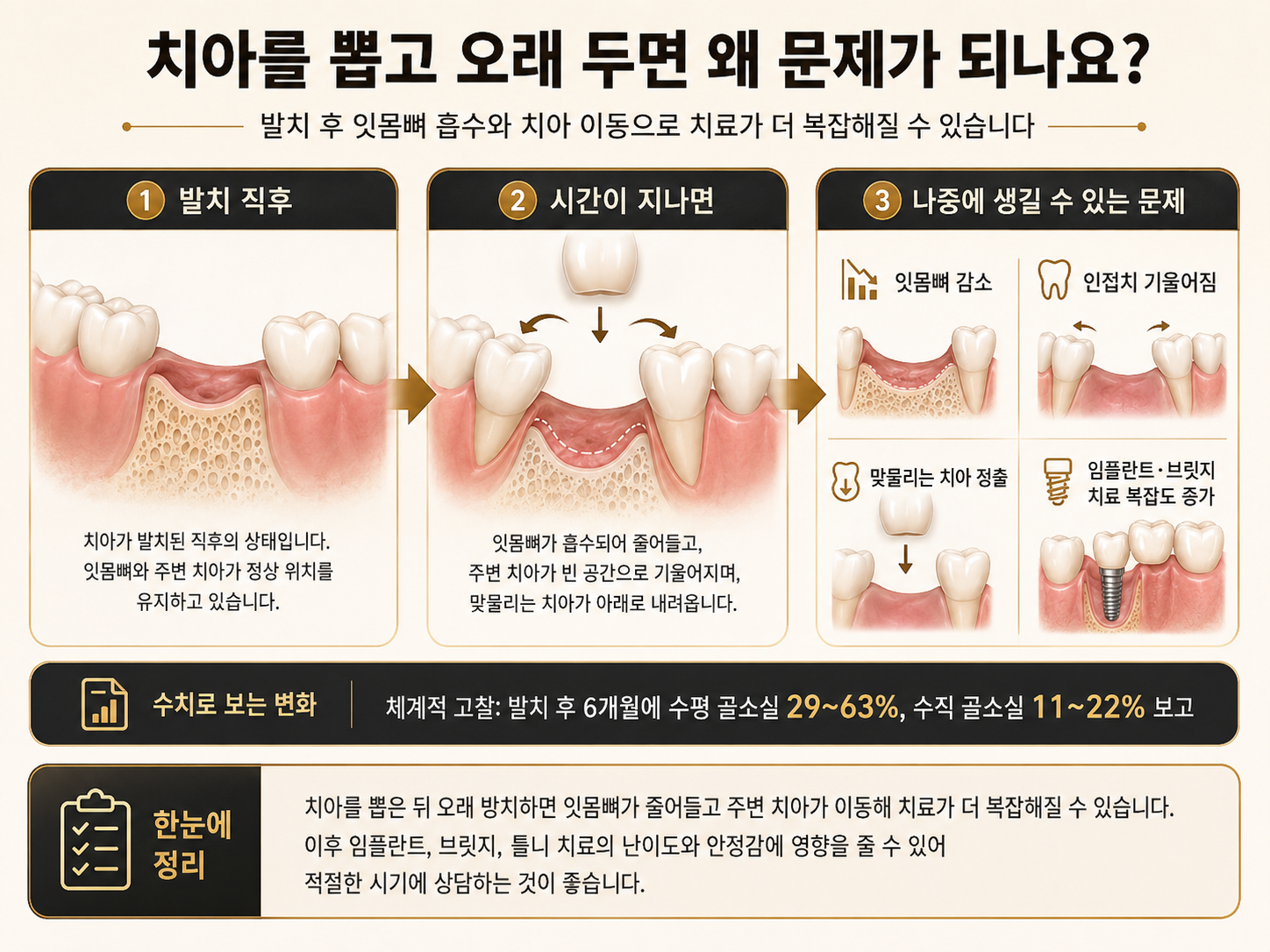 발치 후 잇몸뼈 흡수와 인접치 이동 설명 - 치아 상실 방치 시 변화