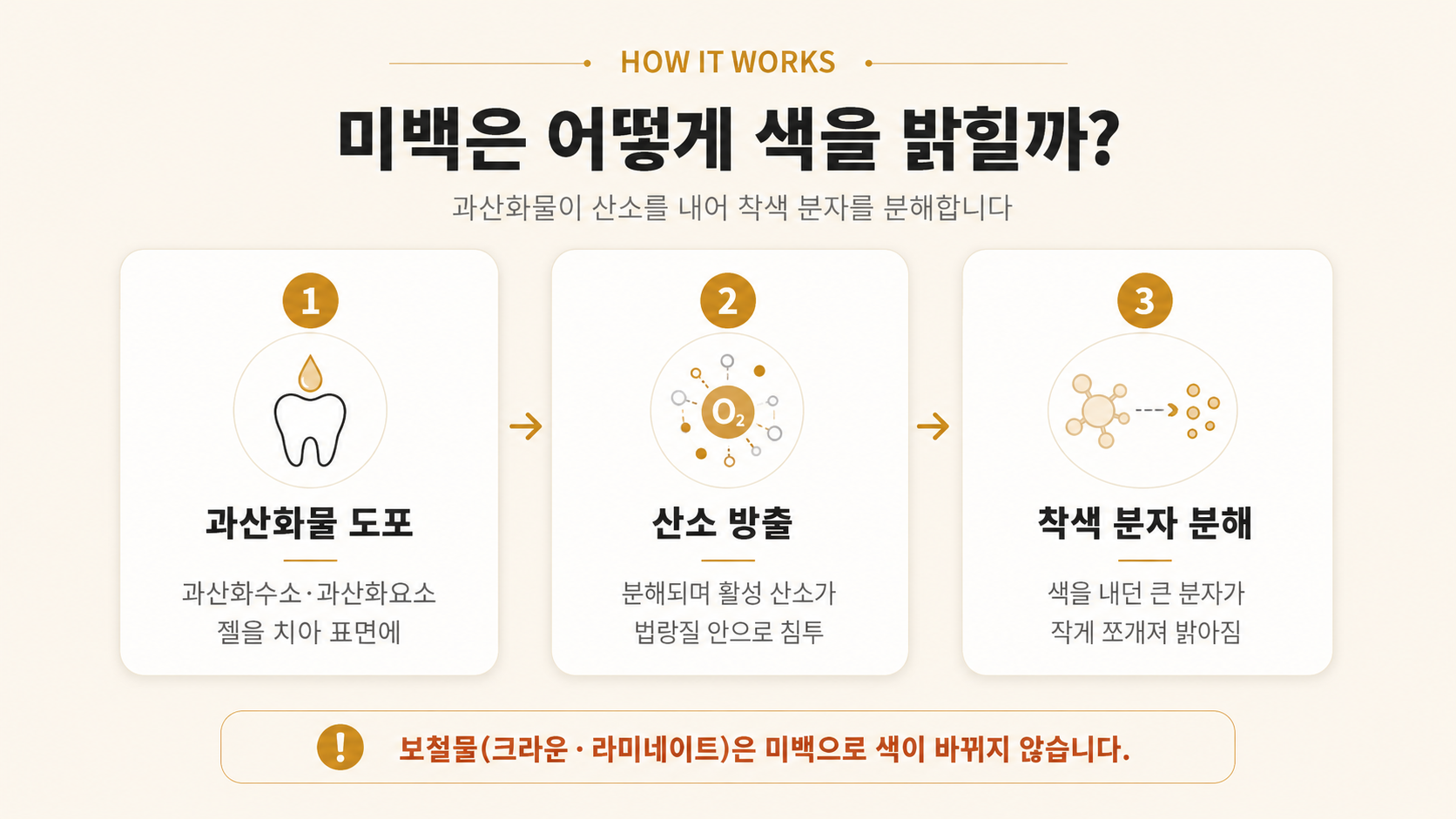 치아미백 작용 원리 인포그래픽 - 과산화물 도포, 산소 방출, 착색 분자 분해의 3단계로 치아미백 원리를 설명하는 이미지