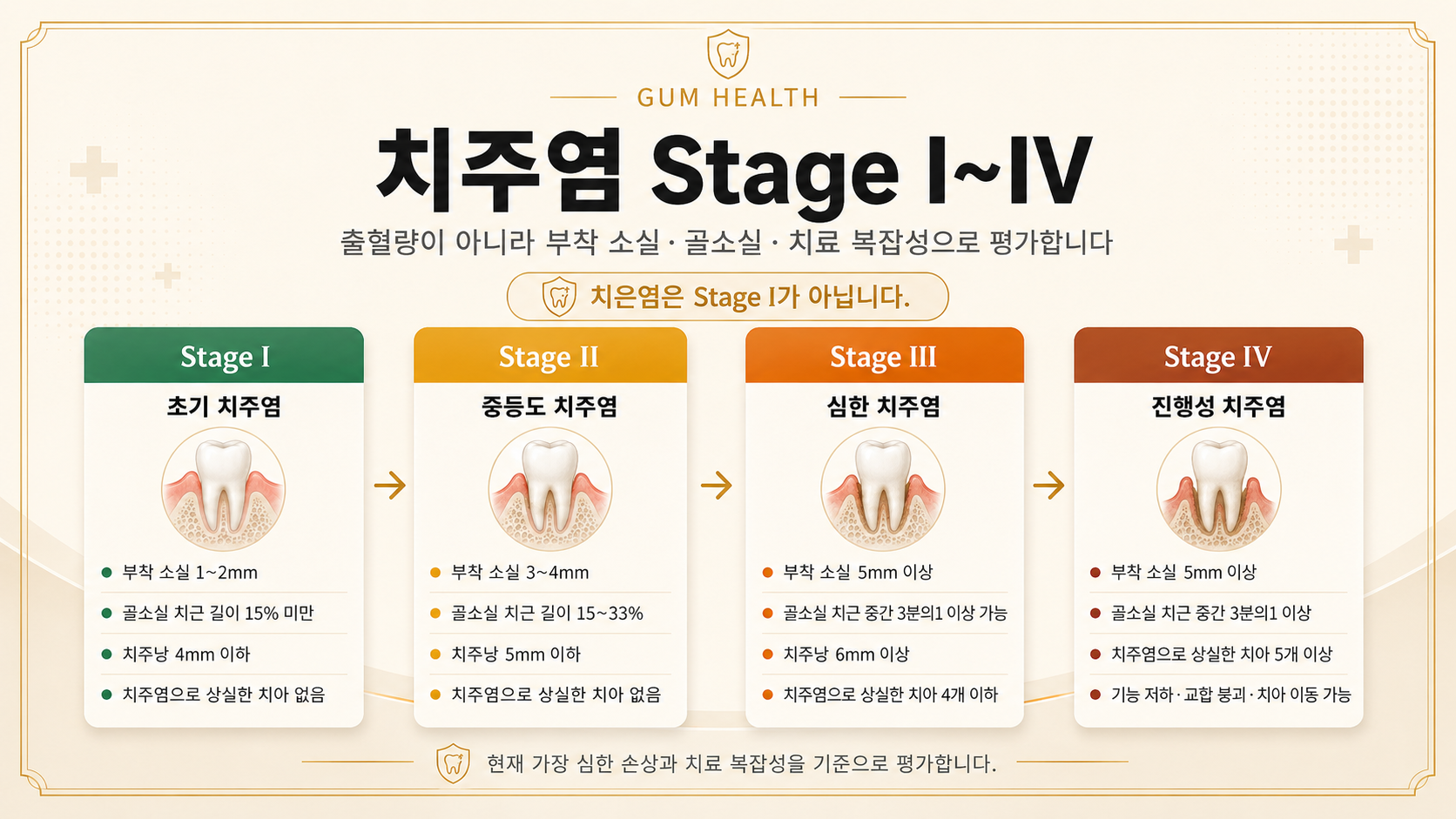 치주염 Stage I부터 IV까지 부착 소실, 골소실, 치주낭 깊이, 치아 상실과 기능 저하 기준을 비교한 인포그래픽