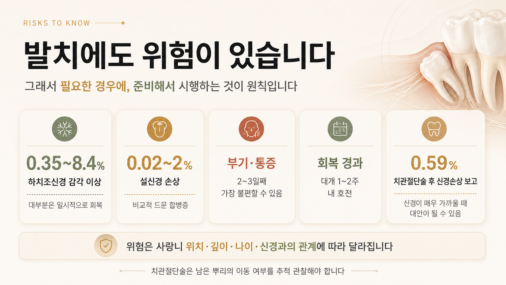 사랑니 발치 후 하치조신경·설신경 감각 이상과 부기·통증·회복 경과, 치관절단술을 설명한 인포그래픽