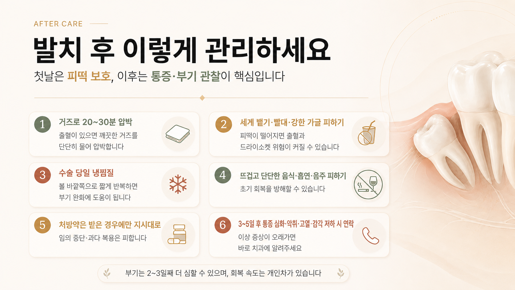 사랑니 발치 후 거즈 압박, 가글·빨대 금지, 냉찜질, 음식·흡연·음주 주의와 이상 증상을 안내한 인포그래픽